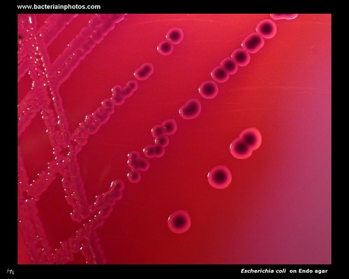 ecoli on Endo